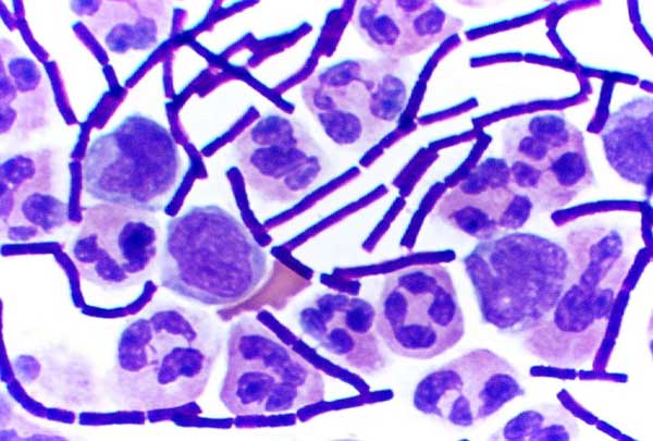 CSU professors discuss the healthy side of bacteria