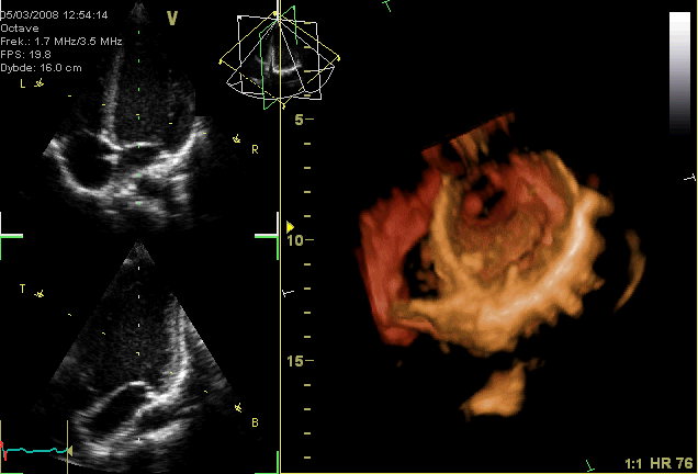 Designing the Heart