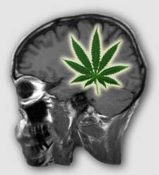 marijuana- cannabis- brain