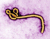 Ebola: Why we are not talking about it anymore