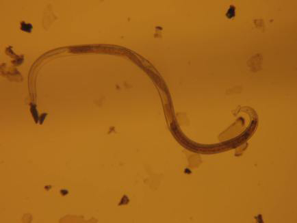 Diana Wall, and her team of researchers study soils in Antarctica and the limited number microscopic species that live in the harsh landscape. Pictured is a female Eudorylaimus, one of the nematodes that lives in the Dry Valleys of Antarctica. (Photo by: Ashley Shaw)