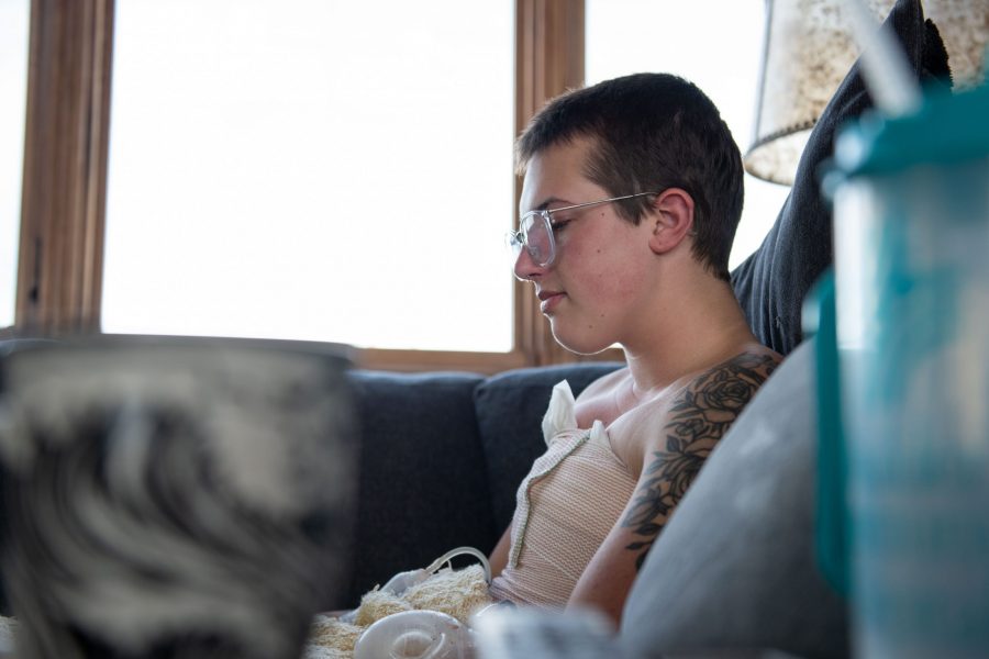 Colorado State Junior, and Women’s and Gender Studies major Kaz Smith recovers and watches TV at his home in Boulder, CO a day after his top surgery Jan. 29. (Colin Shepherd | The Collegian)