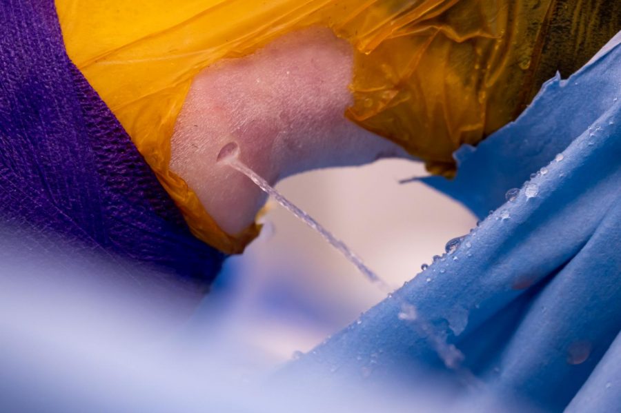 Fluid is drained from Carmen’s leg during surgery at The Johnson Family Equine Hospital that has built up from a tendon tear