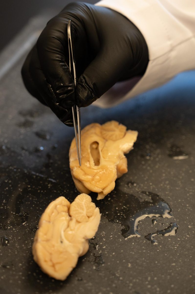 Julie Moreno, a Neurotoxicologist and professor in Prion research at Colorado State University, performs a necropsy on brain samples from both healthy control dogs and dogs suffering from neurodegenerative diseases such as Dementia, April 23rd. The control brain pictured in the foreground is an example of healthy brain tissue while the brain tissue pictured further back is an example of tissue from a dog that suffered from Dementia, as can be seen in the degeneration of the vesicle in the median portion of the brain sample.